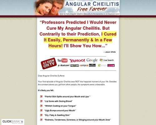 Angular-Cheilitis-Free-Forever-How-to-Cure-Angular-Cheilitis Angular Cheilitis Free Forever - How to Cure Angular Cheilitis Naturally & Permanently in 12 Hours or Less