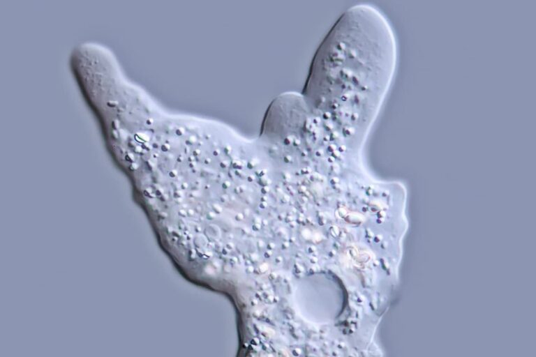 Brain-Eating Amoeba May Have Caused Nebraska Child’s Death