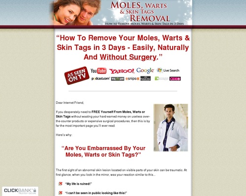 Moles-Warts-Skin-Tags-Removal-How-To-Safely Moles, Warts & Skin Tags Removal - How To Safely & Permanently Remove Moles, Warts & Skin Tags