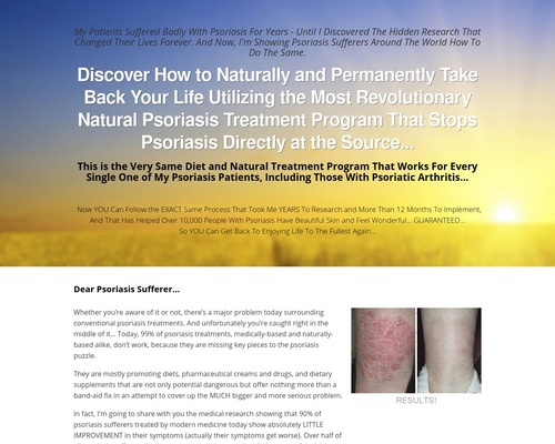 Natural-Psoriasis-Treatment-Program-The-Psoriasis-Program.jpgfit5002C400ssl1 Natural Psoriasis Treatment Program – The Psoriasis Program